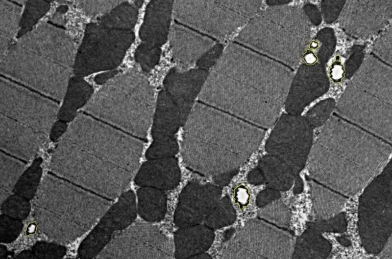 Micrografia eletrônica de músculo de voo de inseto mostrando traquéolos entre fibras musculares