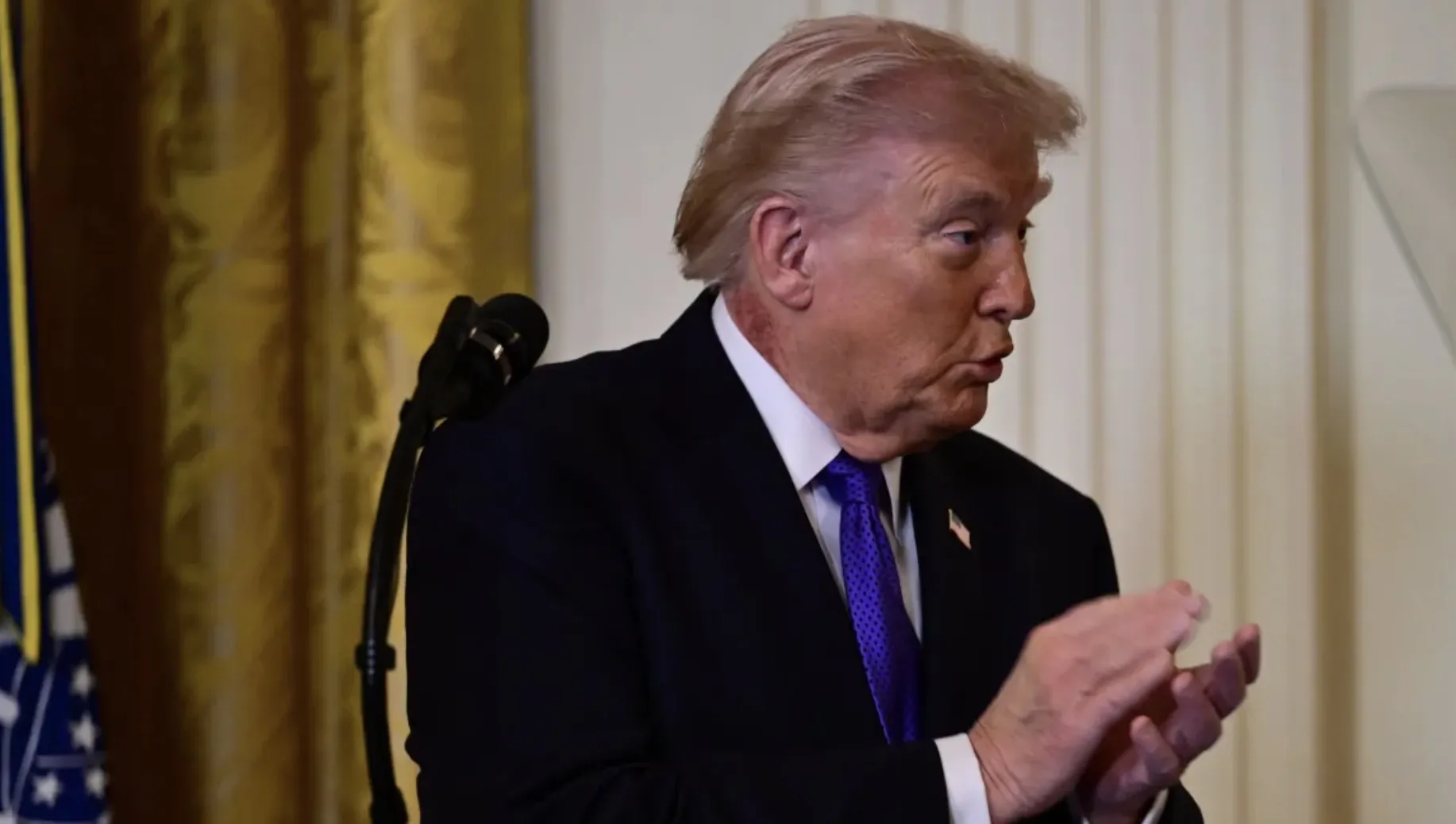 Donald Trump com mancha vermelha visível no pescoço durante cerimônia na Casa Branca